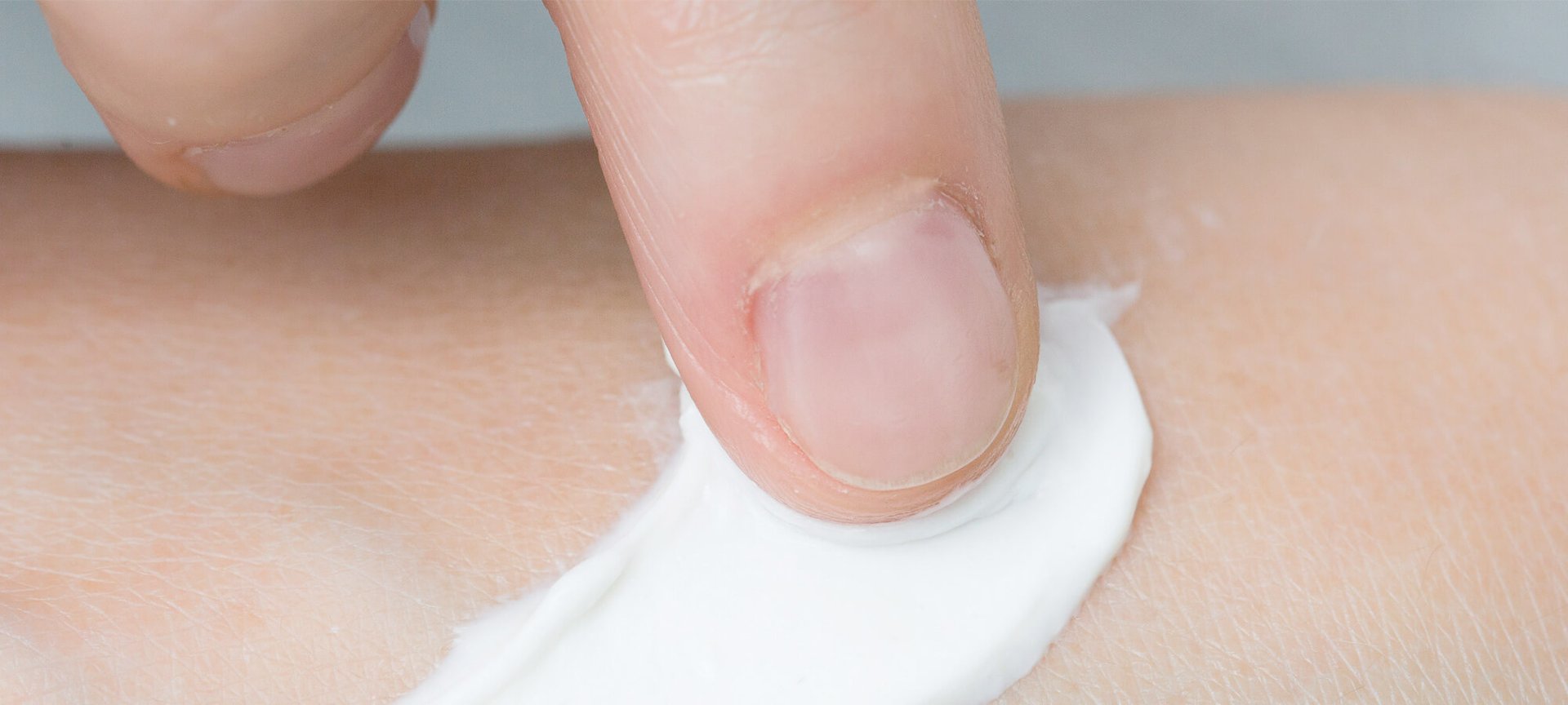 5 Skin Care Tips To Soothe My Sensitive Skin Hero