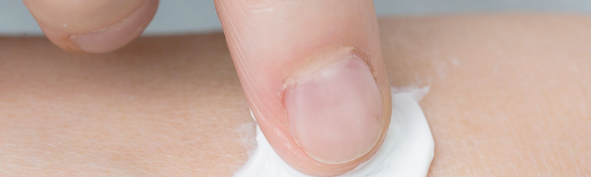 5 Skin Care Tips To Soothe My Sensitive Skin Hero