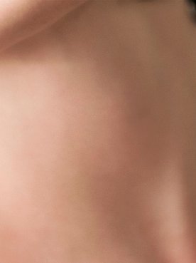 A Guide To Busting Dark Patches Of Skin Hero