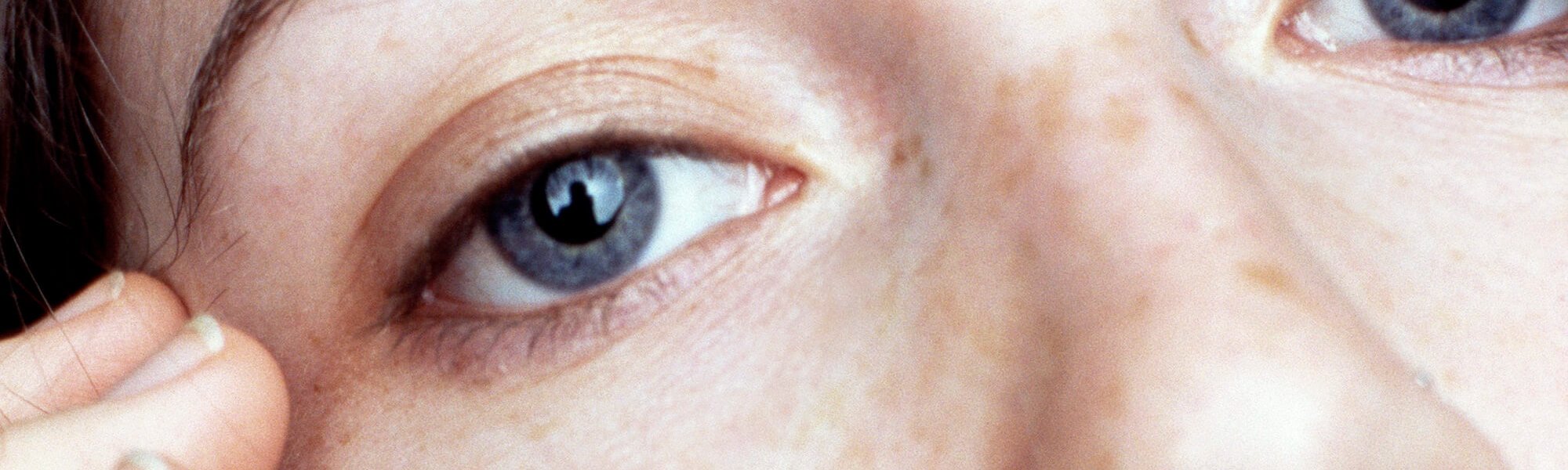 How To Choose The Right Concealer To Banish Dark Circles Hero