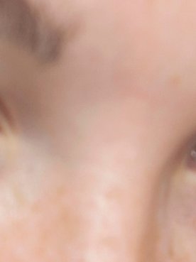 Our Tips To Get Rid Of Eye Bags