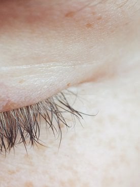 The Best Skincare For Your Eye Area To Help You Look Younger And More Awake Hero