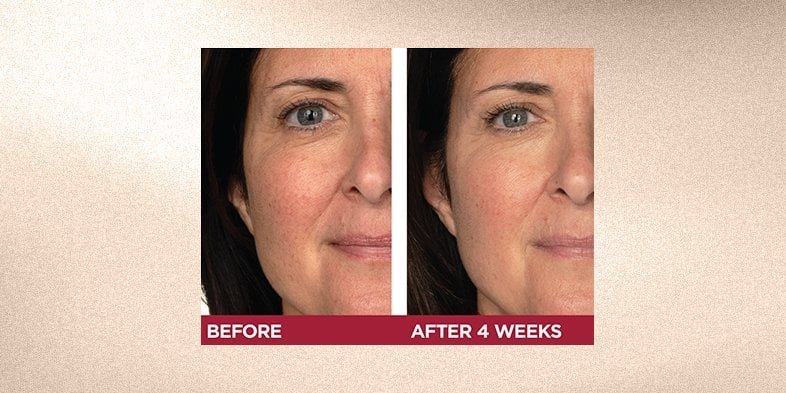 In Article How Does Retinol Work 4