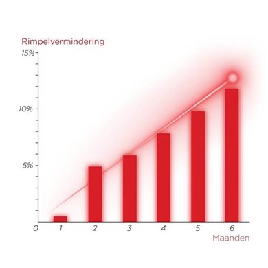 Content Push Laser Studie Graph