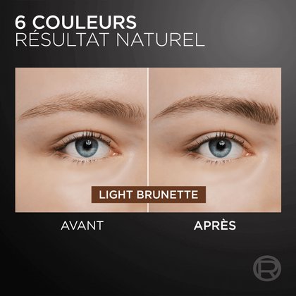 3600524202361 5FR