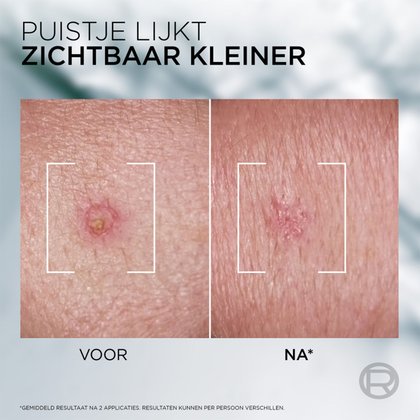 3600524198053 5 NL